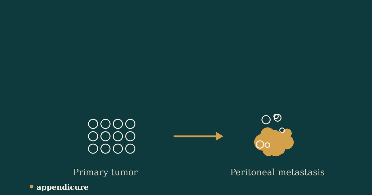 What New Appendix Cancer Organoids Reveal About How the Disease Spreads